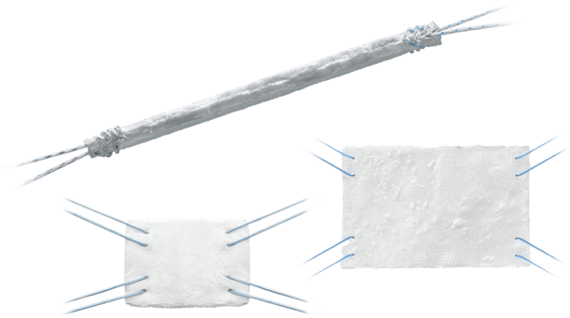 BioBrace<sup>®</sup> Reinforced Bioinductive Implant