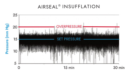 AirSeal insufflation pressure stability chart