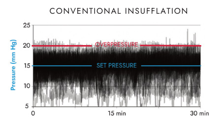Conventional insufflation pressure stability chart