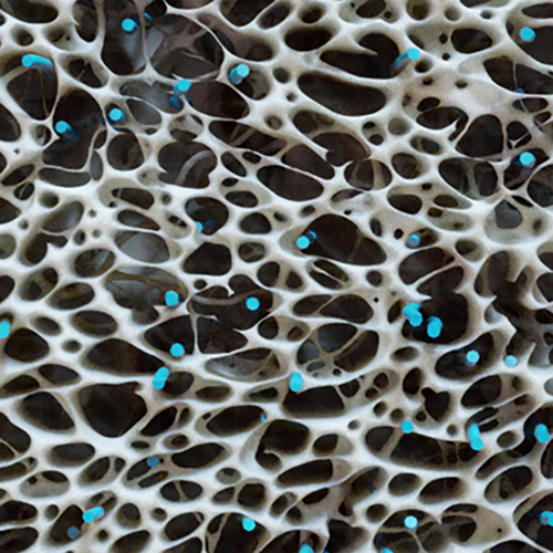 biobrace zoomed in