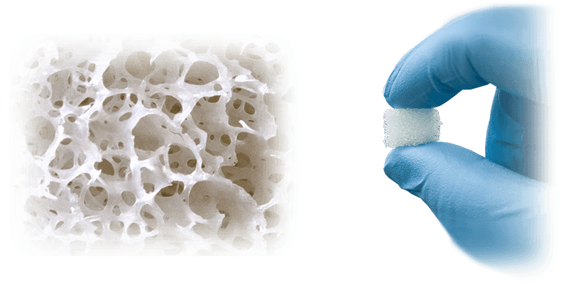 alloaid bone putty
