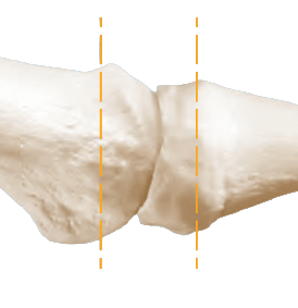 RTS First Straight Cut