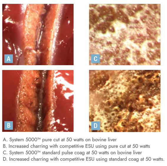 system5000-clinical-comparisons