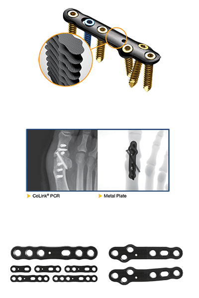 CoLink PCR Plating System | CONMED