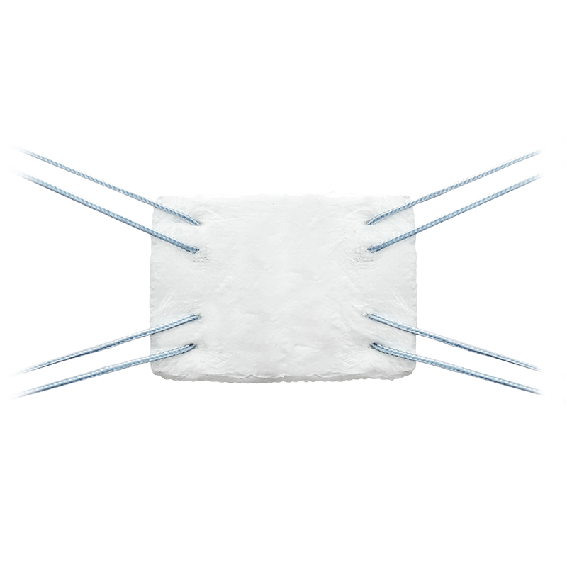 BioBrace<sup>®</sup> Reinforced BioInductive Implant