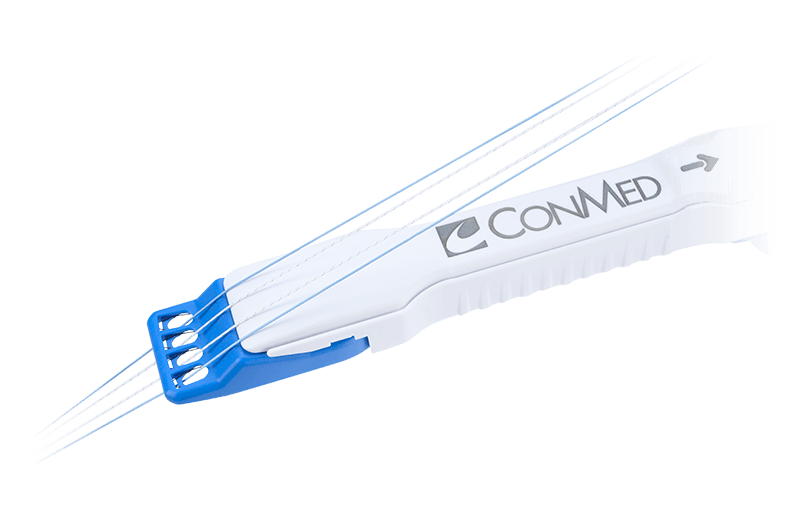 BioBrace®RC Delivery System