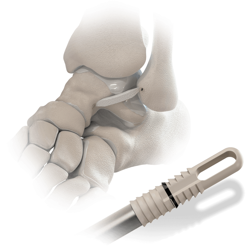 Hercules XE System Diagram