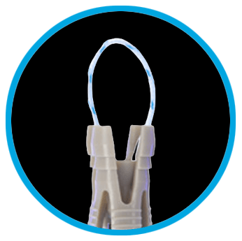 TenoLok™ Deployed 6.0mm