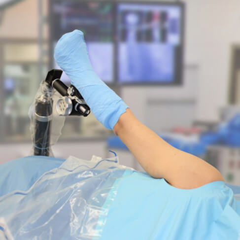 showing the AssistArm in the Lateral Decubitis position