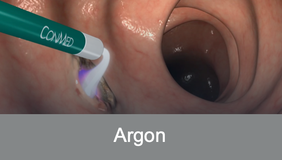 Argon Animation image