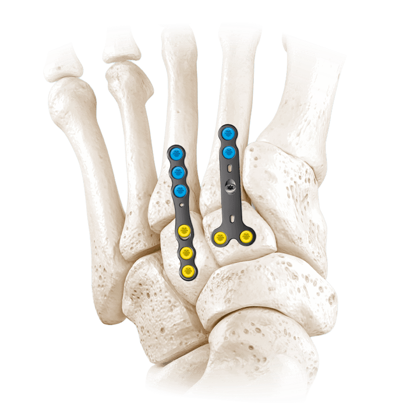 CoLink® XP Plating System